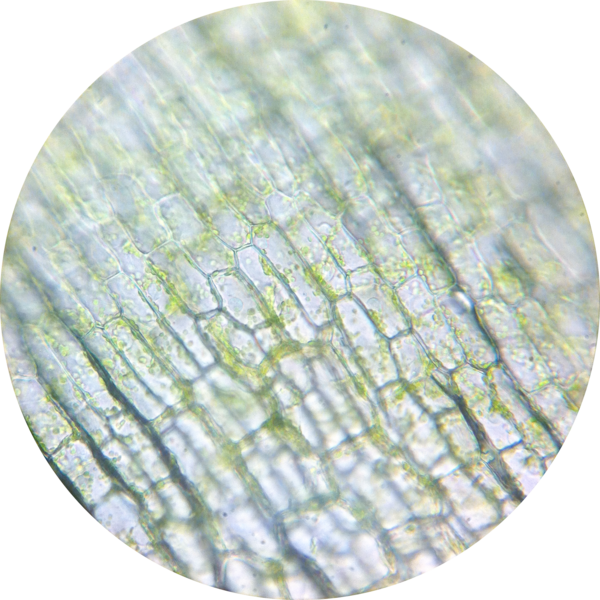 File:Elodea chloroplasts 6 400×.png