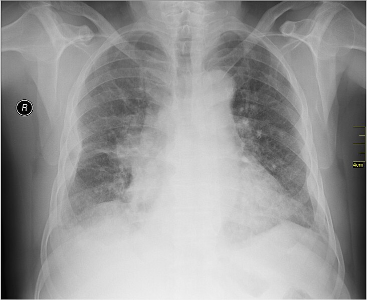 File:Medical X-Ray imaging PRX06 nevit.jpg