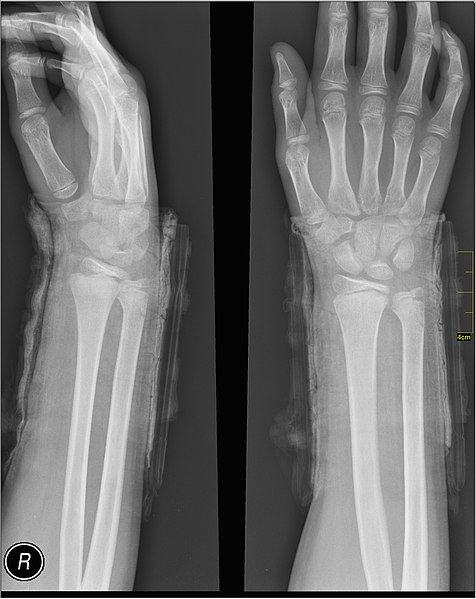 File:Medical X-Ray imaging UDY07 nevit.jpg