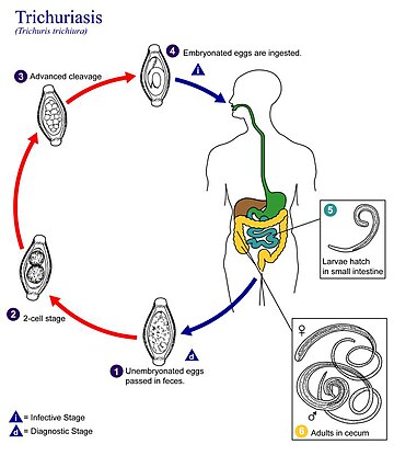 Tricocefalosi