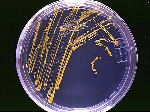 An agar plate – an example of a bacterial growth medium*: Specifically, it is a streak plate; the orange lines and dots are formed by bacterial colonies.