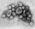 B00526-Swine-flu.png