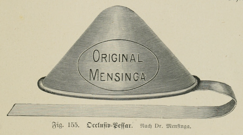 File:Die Frau als Hausärztin (1911) 155 Occlusiv-Pessar.png