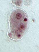 Trophozoit, E. histolytica