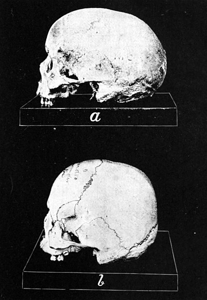 File:European Skull, Hindu Skull.jpg