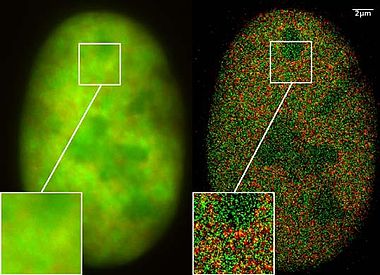 Dual color localization microscopy SPDMphymod/super resolution microscopy with GFP & RFP fusion proteins GFP Superresolution Christoph Cremer.JPG