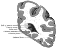 ภาพตัดแบ่งหน้าหลังผ่านส่วนยื่นด้านหลังของโพรงสมองข้าง
