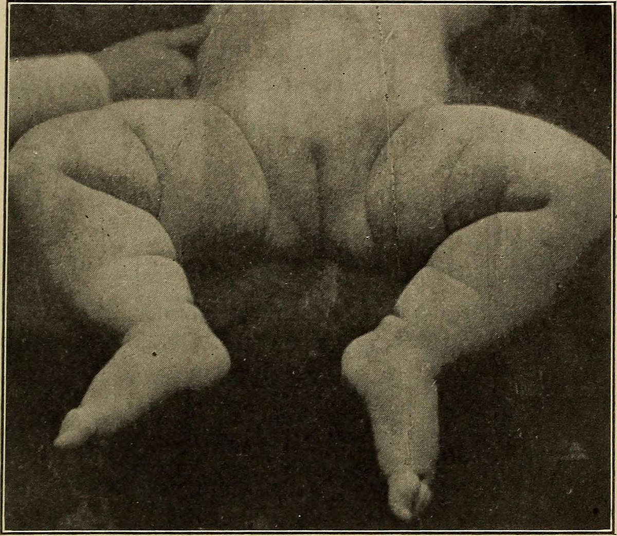 File:Gynecological diagnosis (1910) (14798146003).jpg - Wikimedia Commons 