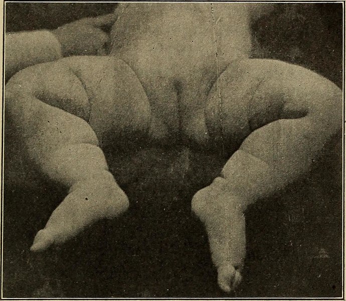 File:Gynecological diagnosis (1910) (14798146003).jpg