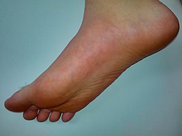 Human male foot.jpg