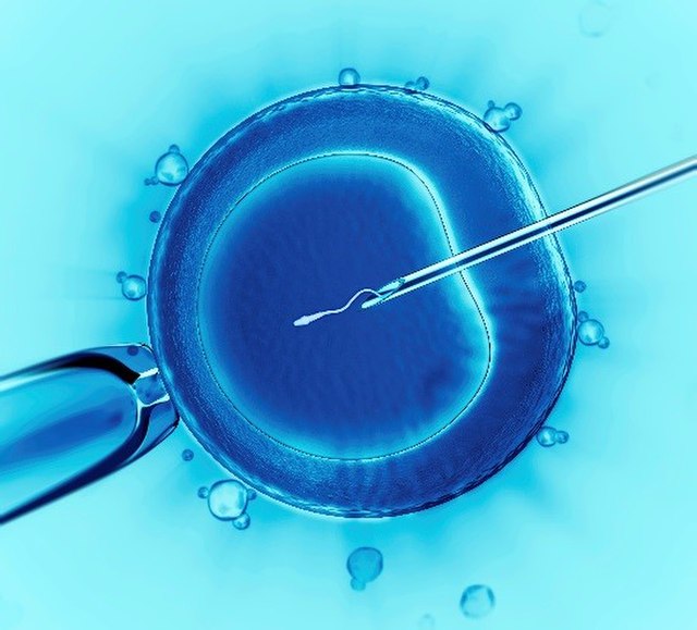 This image shows intracytoplasmic sperm injection, the most commonly used IVF technique.
