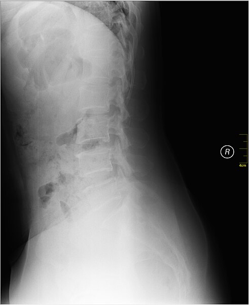 File:Medical X-Ray imaging TOI07 nevit.jpg