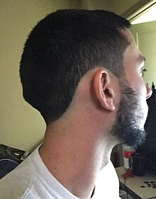 Occipital bun on a modern human male Occipital bun modern human male.jpg