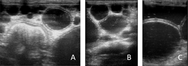 File:Parasite180022-fig1 Cystic echinococcosis in a cat.png