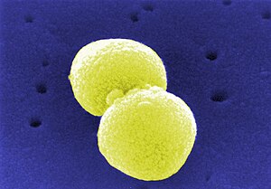 Streptococcus pneumoniae secondary electron micrograph, colored