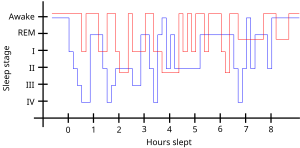 Diagramme des habitudes de sommeil RLS - en.svg