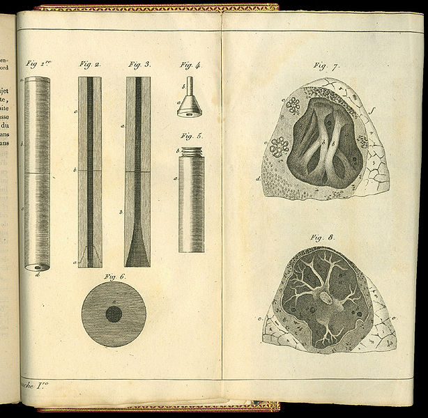 File:Rene-Theophile-Hyacinthe Laennec (1781-1826) Drawings stethoscope and lungs.jpg