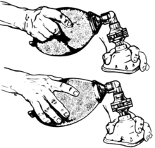 Operation of bag valve mask Resuscitator 3 - Operation (PSF).png