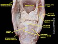 Larynx. Deep dissection. Posterior view.