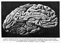 Adult brain; Lateral side of left hemisphere Wellcome L0001031EA.jpg