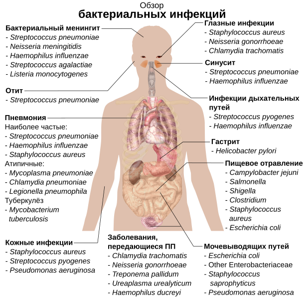 File:Bacterial infections and involved species-ru.svg