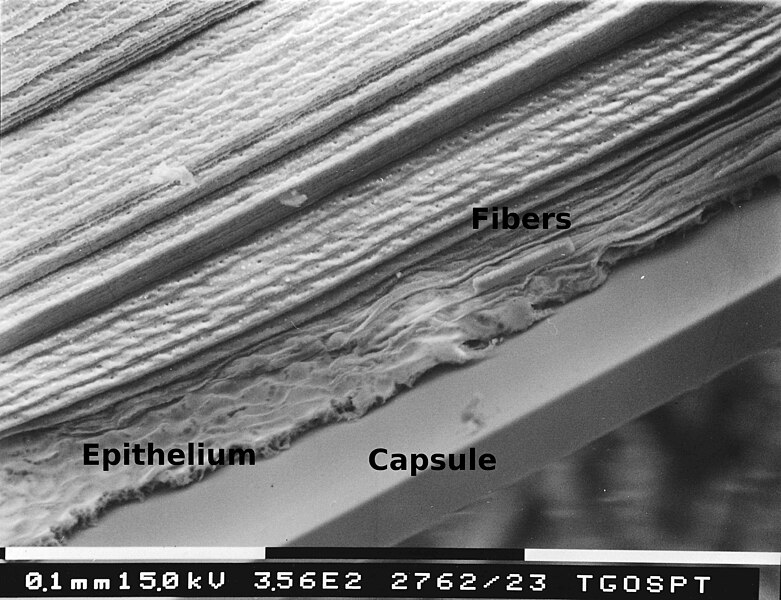 File:Lens fibre-epithelium-capsule.jpg
