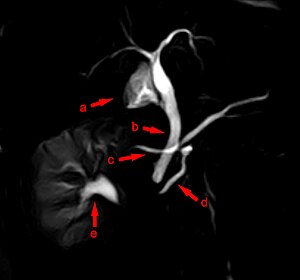 Bauchspeicheldrüse: Anatomie beim Menschen, Anatomie bei Tieren, Entwicklung