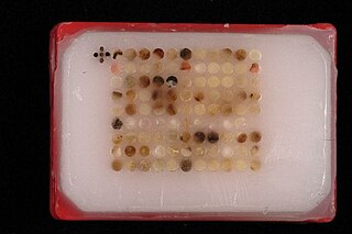 <span class="mw-page-title-main">Tissue microarray</span>