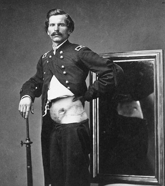 File:Wbell-barnum-gunshot-wound-crop.jpg