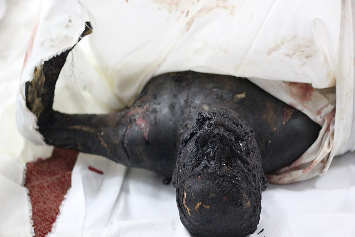 1200px-Burned_dead_body_in_RABIA_Massacre.jpg