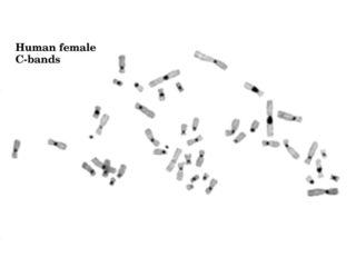 <span class="mw-page-title-main">Constitutive heterochromatin</span>