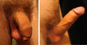 Flaccid and erect human penis.jpg