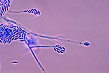 La 01.jpg Fusarium