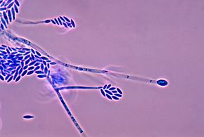 Description de l'image Fusarium verticillioides 01.jpg.