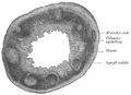 Sección transversal de apéndice vermiforme humano (X 20).