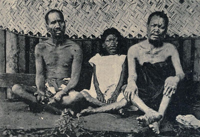 File:Lepers, Tahiti (1898).jpg