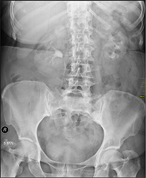 File:Medical X-Ray imaging BOC02 nevit.jpg