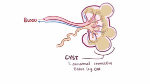 Dosiero: Multicista rendisease.ŭebm