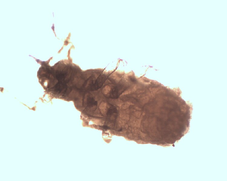 Ficheiro:Pemphigus-spirothecae under microscope sexupara.jpg