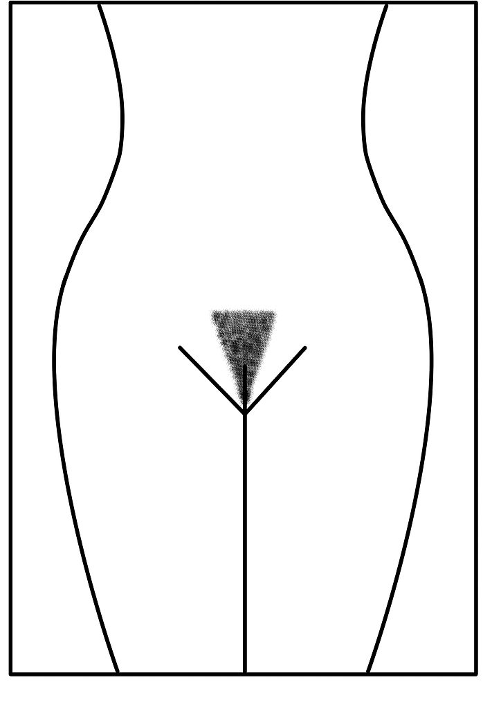 File:Pubic hair style Bikini Line.jpg - Wikimedia Commons