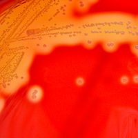 Streptococcus pyogenes (Lancefield Group A) on Columbia Horse Blood Agar - Detail.jpg