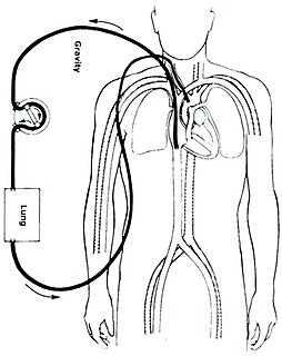 <span class="mw-page-title-main">Extracorporeal membrane oxygenation</span> Technique of providing both cardiac and respiratory support