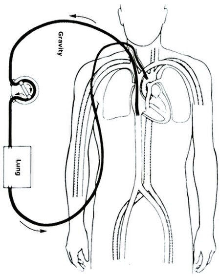 Trao đổi oxy qua màng ngoài cơ thể