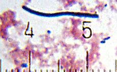Lactobacillus delbrueckii subspecies bulgaricus from a sample of Activia® brand yogurt