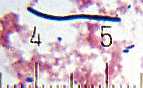 "Lactobacillus delbrueckii" subsp. "bulgaricus" from a sample of yogurt. Numbered ticks are 11 μm apart.