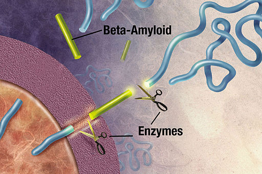 Amyloid 02big1