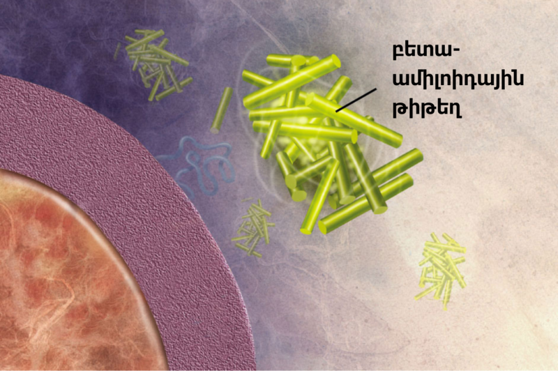 File:Amyloid 03big1 (hy).png