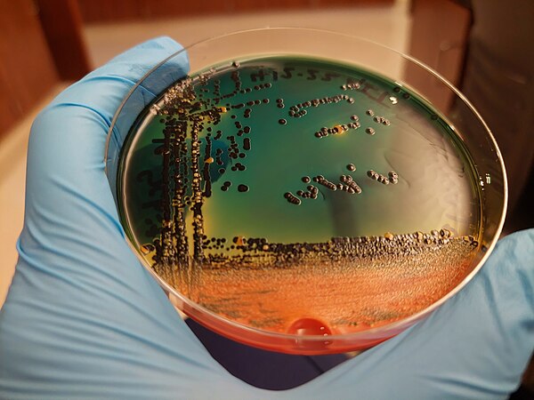 Hektoen enteric agar plate on which a stool sample has been culture, exhibiting both lactose fermentation (orange) and hydrogen sulfide production (black). Photo by Mediocreclementine