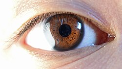 Human eye with limbal ring, anterior view.jpg