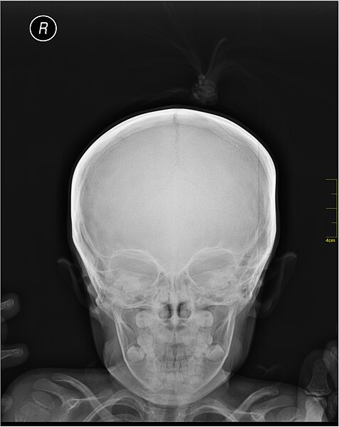 File:Medical X-Ray imaging UGJ07 nevit.jpg